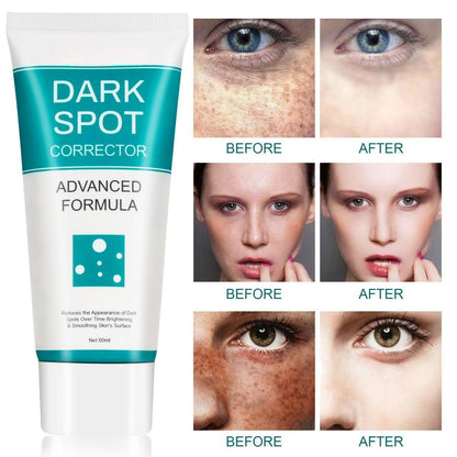 Dark Spot Corrector For Face 60 ml